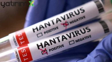 Sağlık Bakanlığı'ndan Hantavirüs açıklaması: Türkiye'de vaka var mı?
